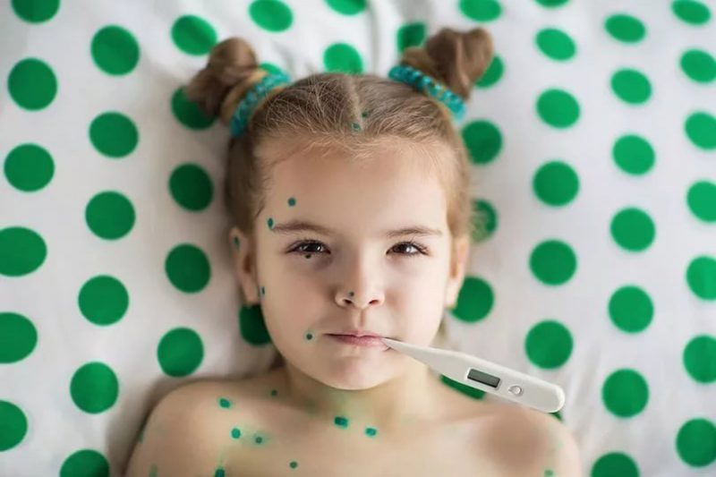 Прививка от ветрянки детям: сколько действует, когда делают, как называется вакцина