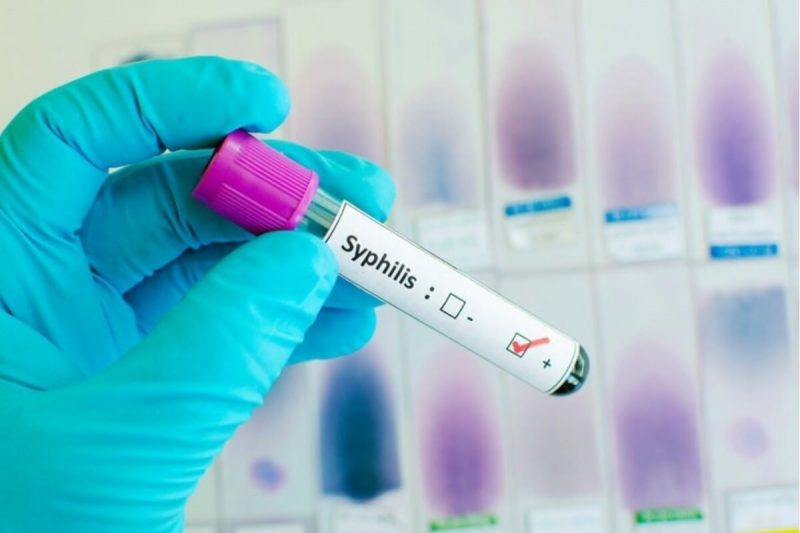 Как передается сифилис, как не заразиться, методы диагностики заболевания