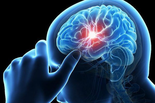 Синдром Арнольда – Киари: что это такое, симптомы и диагностика патологии мозга, лечение