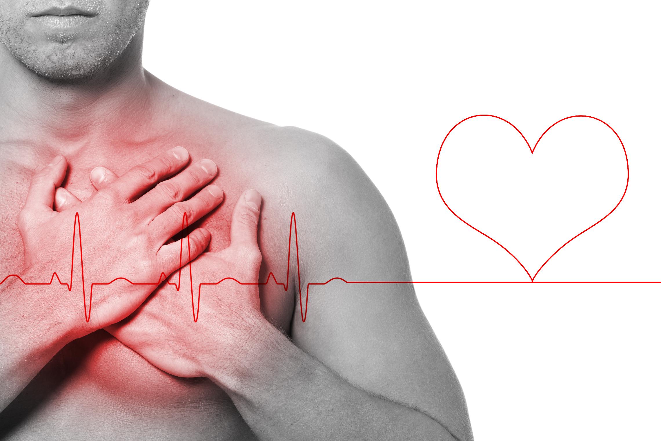 Что такое аритмия: виды, причины, симптомы, диагностика и лечение аритмии сердца