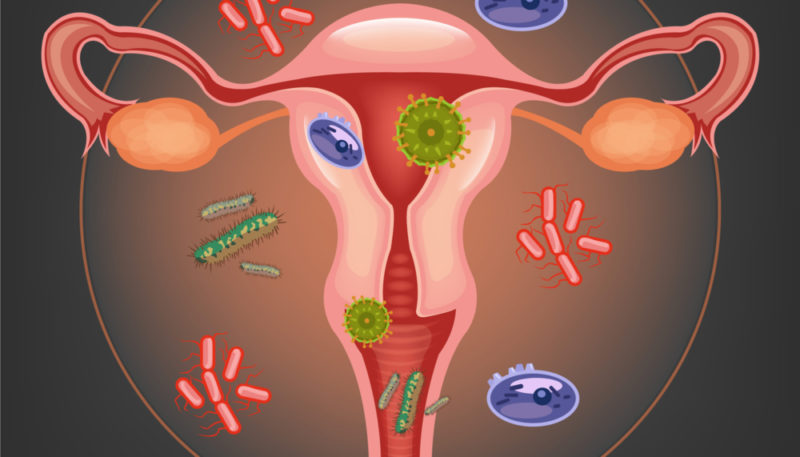 Гарднерелла вагиналис (Gardnerella vaginalis): у мужчин и женщин, как передается, симптомы и лечение гарднереллеза