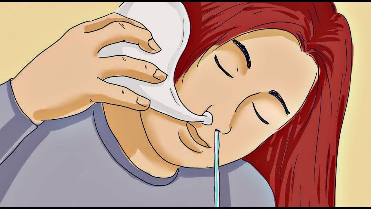 Кукушка — промывание носа по Проетцу: описание, подготовка к процедуре, показания и противопоказания, возможные осложнения